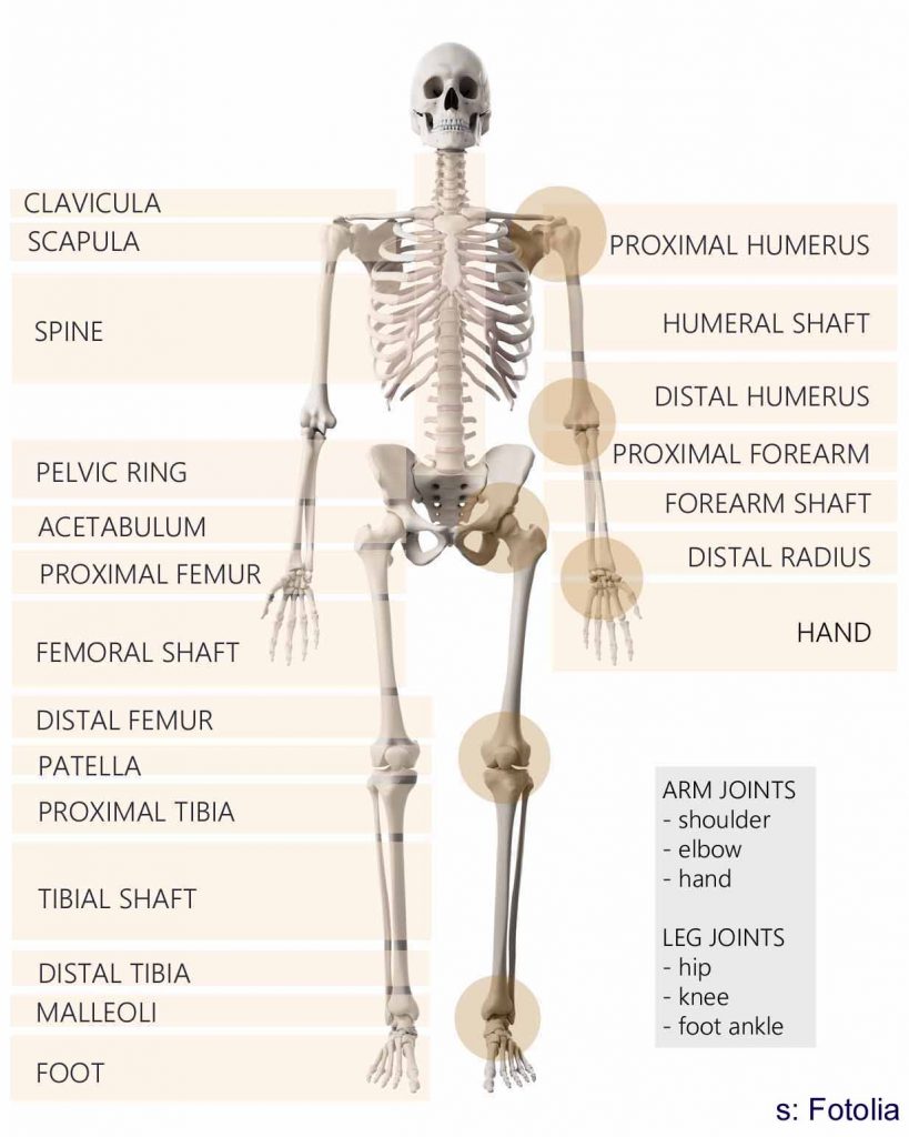 PATIENT INFORMATION: Skeletal System Implants (