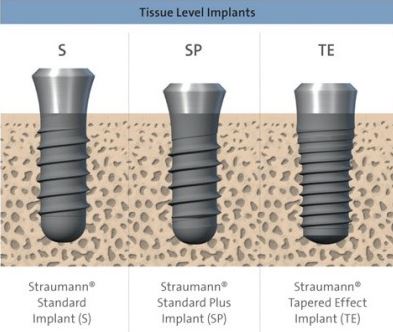 Straumann Tissue Level Implants THE IMPLANT REGISTER